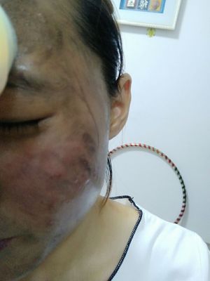 Капсулы для детоксикации лица 100 шт, профессиональное использование с ультразвуковым аппаратом для удаления свинца и ртути, отбеливание лица и осветление пятен