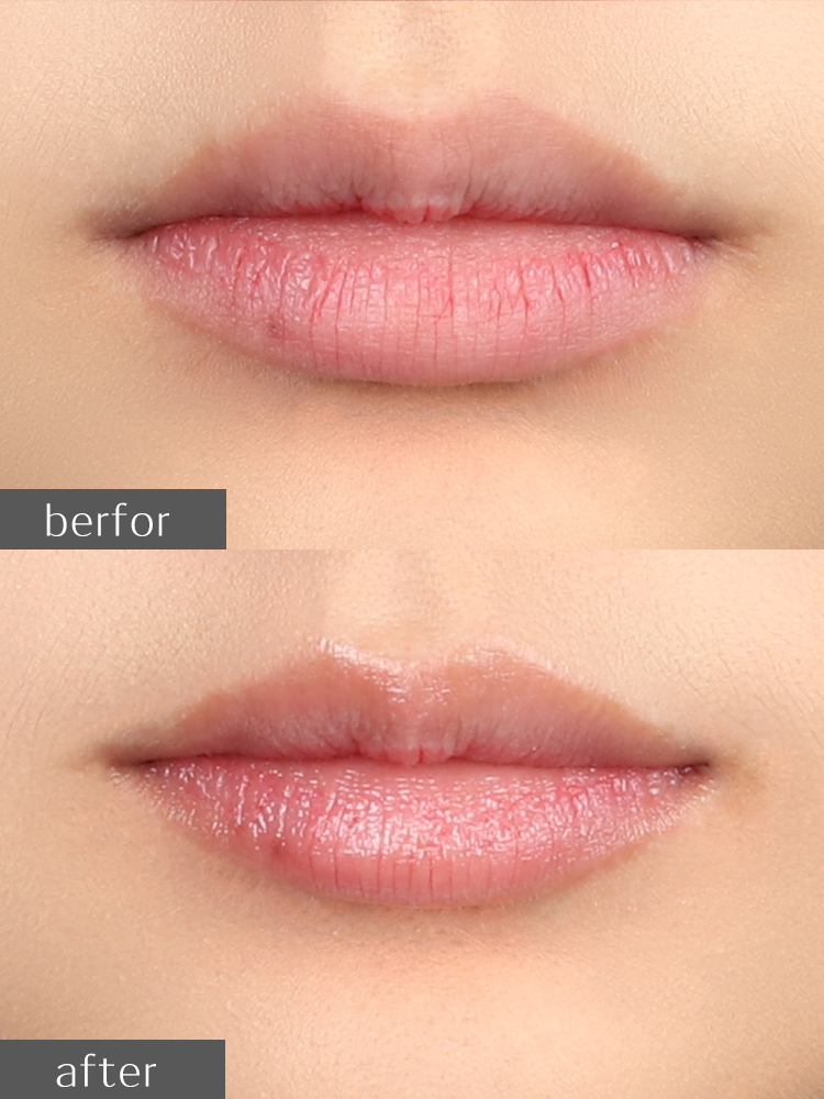 日本COSME大赏omi近江兄弟薄荷润唇膏女保湿滋润护唇膏无色修护男