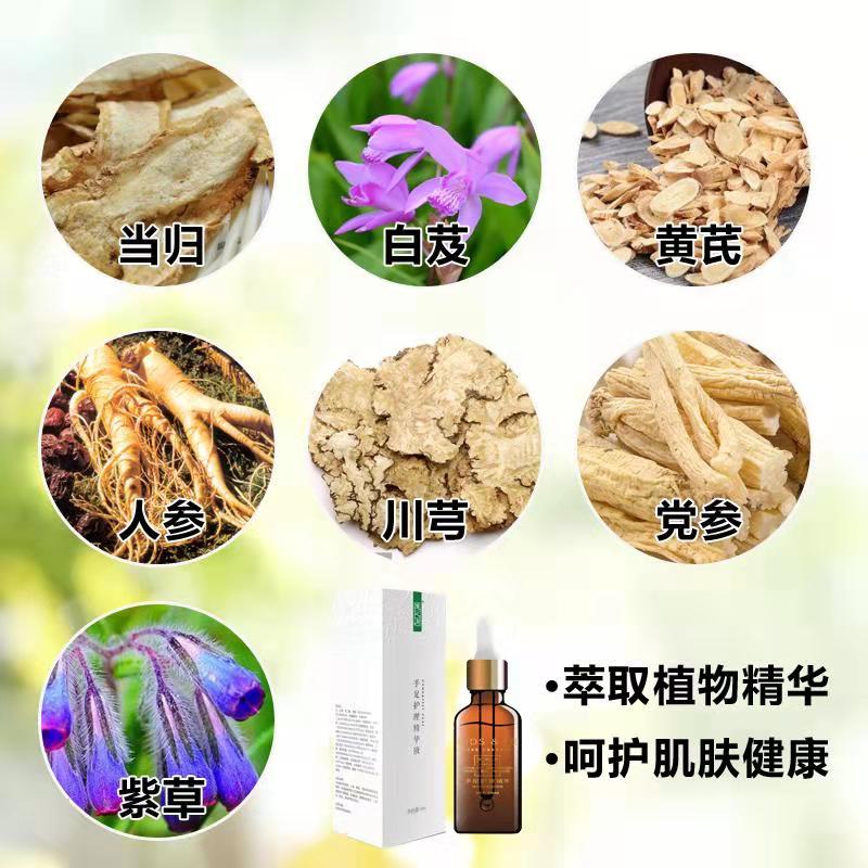 Жидкость для ухода за руками и ногами Zhongyitang для трещин на пятках, сухой, трескающейся кожи, шелушения и мозолей