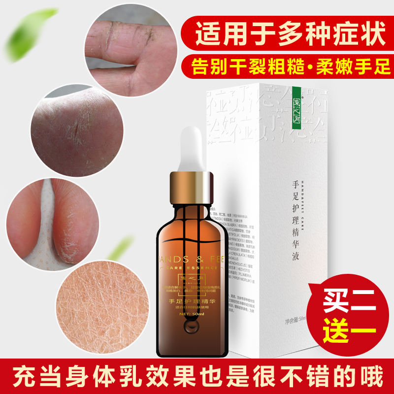 Жидкость для ухода за руками и ногами Zhongyitang для трещин на пятках, сухой, трескающейся кожи, шелушения и мозолей